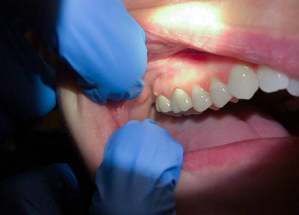 Best 24-Hour Emergency Dentist in Patrick Springs, VA